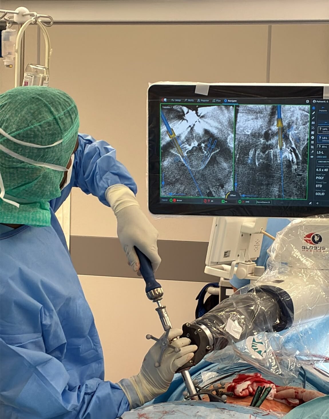 Dr. Ganesh Kumar performing minimally invasive robotic spine surgery using a Globus Medical robotic arm and real-time surgical navigation screen.